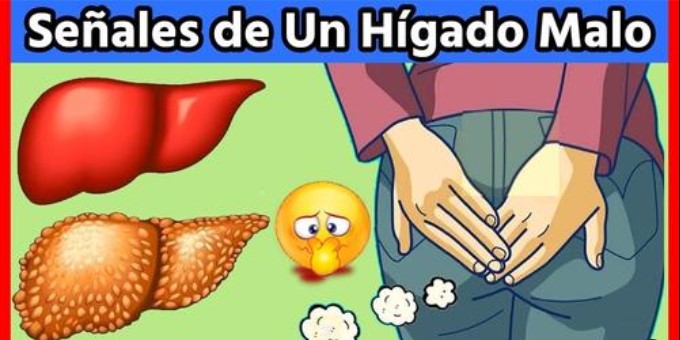 Síntomas de un Hígado Enfermo
